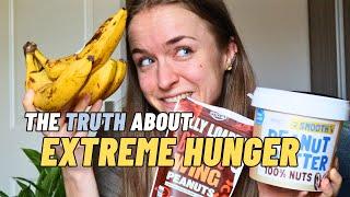 EXTREME HUNGER when Weight-Restored (is it emotional eating?)