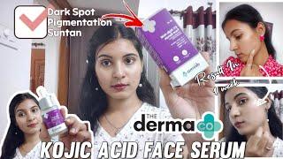 DARKSPOT PIGMENTATION SUNTAN "the Dermco Kojic Acid Serum" Does It Really Works ?