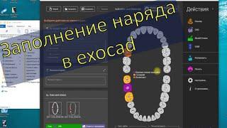 Этапы заполнения наряда в exocad. Цементный зазор.