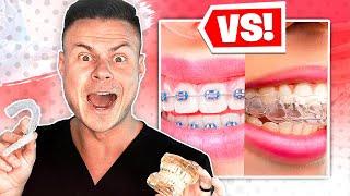 BRACES VS INVISALIGN … Which Is Best?!