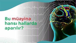 Elektroensefaloqrafiya (EEQ) müayinəsi |  Bu müayinə hansı hallarda aparılır?