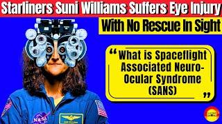 Starliner Crew Health Worsens Each Day NASA Delays! Suni Suffers Eye Damage While Waiting For Rescue