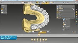 inLab SW 18: 1-to-1 Copy