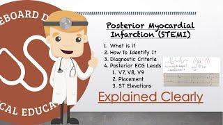 Posterior Myocardial Infarction Basics - Diagnosis, ECG, Leads V7, V8, V9 | Clinical Medicine