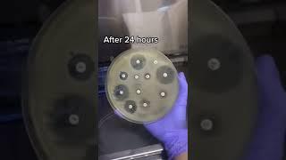 ANTIMICROBIAL SUSCEPTIBILITY TESTING. #shorts #microbiology #microorganisms #microbialinsider