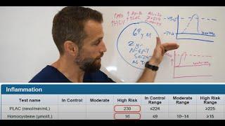 Seizures - what is causing your Non-Epileptic Seizures? Are they metabolically driven pseudoseizures