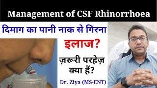 Dimag ka Pani naak se girne ka ilaj. Treatment of CSF Rhinorrhea.