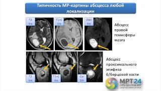 Мельников Мужcкой малый таз Мастер-класс