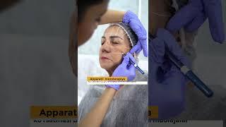 Bepul Yuz Diagnostika!Birinchi protsedur uchun 70% chegirma!#yuz90 0163388 Toshkent Oltin markaz