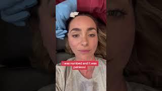 TESTING COSMETIC THREADS!  Great for younger folks who don’t yet qualify for a facelift. #threads