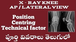 x ray right knee position ap lateral view in telugu