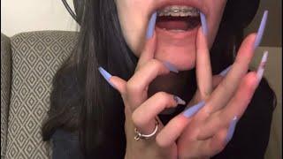 ASMR Teeth Tapping with Braces|| Long Nail Tapping, Scratching, and hand sounds