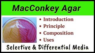 MacConkey Agar | Composition of McConkey agar