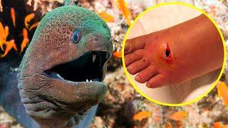 The Most POISONOUS And VENOMOUS FISHES In The World