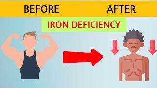 Iron Deficiency Anemia Symptoms #anemia  #ironrichfoods  #symptoms  #irondeficiency