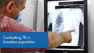 Battling tuberculosis in the time of COVID-19