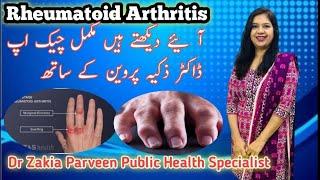 Rheumatoid Arthritis | dr 001| Dr Zakia Perveen| Preperation of Toacs |Osce| #arthritis Urdu/Hindi