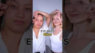 eye bags gone #eyebags #facefitness #facialyoga #facialfitness