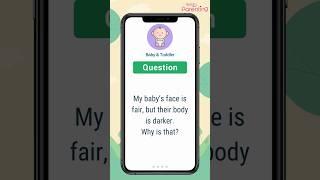 Baby Q&A : My baby’s face is fair but their body is darker — Why is that?