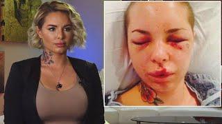 War Machine's Ex, Christy Mack, Opens up About Being Beaten by Former MMA Star