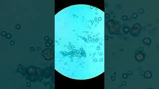 urinary crystal the under microscope.