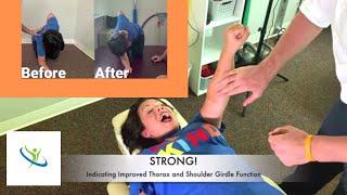 University of Tennessee Professor Gets Chiropractic Adjustment Loud Crack Post Mastectomy