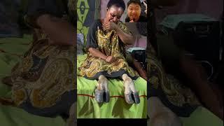 hebohwanita ini kakinya berubah menjadi kaki sapi