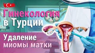 Удаление миомы матки в Турции. Гинекология в Турции.