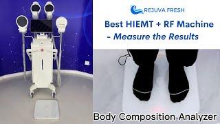 EMShape Neo Body Contouring Machine - Best Professional HIEMT Body Sculpting Machine with RF