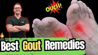 What is Gout? TRUE Causes & Treatments! [Symptoms, Diet & Diagnosis]