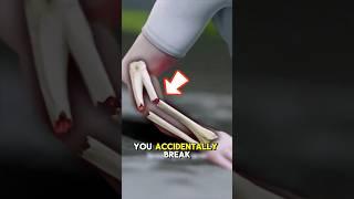 How to Provide First Aid for a Broken Arm in Seconds!