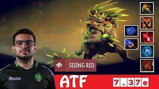 [DOTA 2] ATF the BRISTLEBACK [TEAM FALCONS vs OG] [BLAST SLAM I]