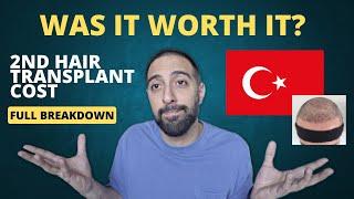 FULL COST of a 2nd Hair Transplant from Turkey