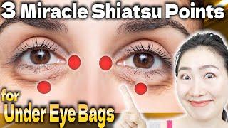 3 Miracle Shiatsu Points to Massage Dramatically Removes Under Eye Bags