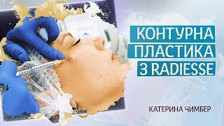 Контурна пластика середньої третини обличчя з Radiesse