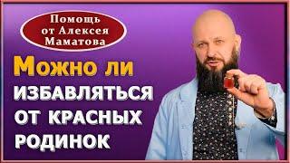 Красные родинки на теле. Что это такое? Можно ли от них избавиться? Доктор Алексей Маматов