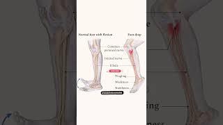 #anatomy #leg #fitness
