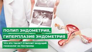 Полип эндометрия гиперплазия эндометрия. Что это такое? Отвечает ведущий гинеколог из Костромы