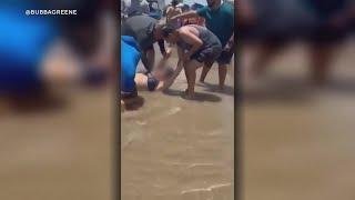 Two bitten by sharks at South Padre Island