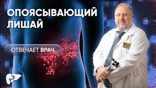 Опоясывающий лишай (опоясывающий герпес или Herpes Zoster) - взгляд невролога