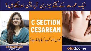 Ek Aurat Ke Kitne Cesarean Ho Sakte- How Many C Sections Can A Woman Have Safely- Multiple C Section