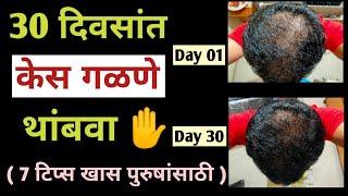 ३० दिवसात केस गळणे थांबवा (७ टिप्स खास पुरुषांसाठी )/ केस गळतीवर उपाय | SACHIN SAMEL