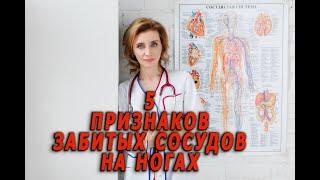 5 признаков забитых сосудов ног. Кардиолог. Анна Кореневич