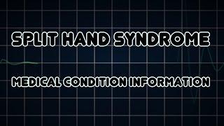 Split hand syndrome (Medical Condition)