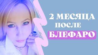 Нижняя блефаропластика через два месяца