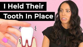 Do Deep Cleanings Make Teeth Fall Out?