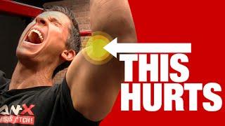 Elbow Pain with Pullups (QUICK FIX!)