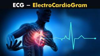 Why ECG (Electrocardiogram) is performed?