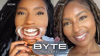 Fixing my TEETH!! Affordable Aligners to Straighten Teeth| My Byte Journey Update | iamLindaElaine