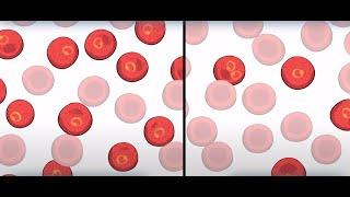 Sickle Cell: Natural Selection in Humans | HHMI BioInteractive Video